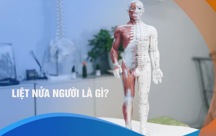 Liệt nửa người là gì? Nguyên nhân, triệu chứng, chẩn đoán và các phương pháp điều trị